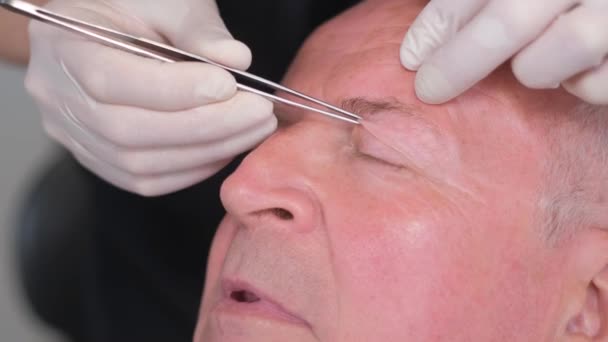 目の領域を変更するには 整形手術の前に老人の顔のクローズアップ — ストック動画
