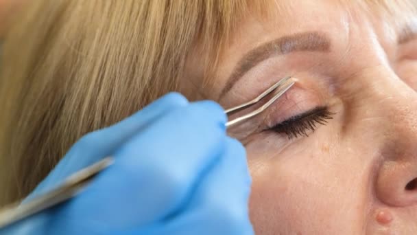 Cirujano Plástico Examina Las Arrugas Viejas Bajo Los Ojos Una — Vídeo de stock