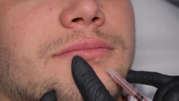 Seorang Kosmolog Memberikan Seseorang Suntikan Untuk Meningkatkan Bibir Kosmetologi Pria — Stok Video