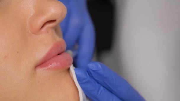 Ein Kosmetiker Spritzt Einem Schönen Mädchen Injektionen Die Lippen Lippenvergrößerung — Stockvideo
