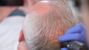 Yaşlı bir adam bir tricholog tarafından muayene ediliyor. Yaşlılıkta saç dökülmesi sorunu.