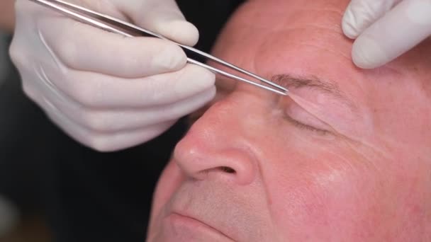 外科医は 目の領域を変更するには 整形手術の前に老人の顔を調べます 整形外科医の養成 — ストック動画