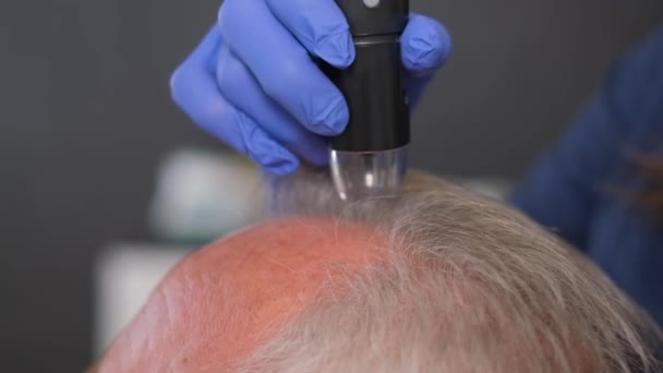Bir Trikolog Detaylı Bir Saç Teşhisi Koyar Yaşlı Bir Adamı — Stok video