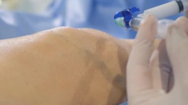 Bir hastanın koluna ve dizine yapılan iğnenin büyütülmüş görüntüsü. Anestezi. Acısız tedavi