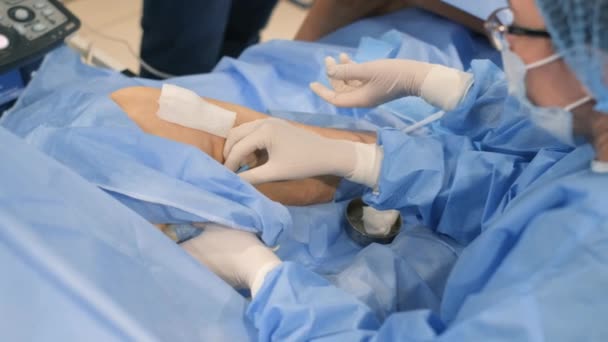 静脈瘤のための脚の外科手術 外科医は下肢で手術を行う 無菌操作ツール — ストック動画