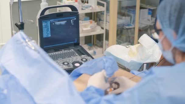 手术室下肢静脉曲张的外科治疗 外科医生和他的小组对病人进行复杂的手术 — 图库视频影像
