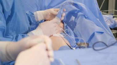 Operation for varicose veins. The process of operation by a group of medical personnel, doctors.