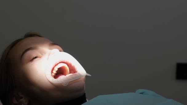 歯科治療中に口を開いている女性患者 治療中のCapa 口腔疾患の治療のプロセス 近代的な方法を用いた歯の治療 — ストック動画