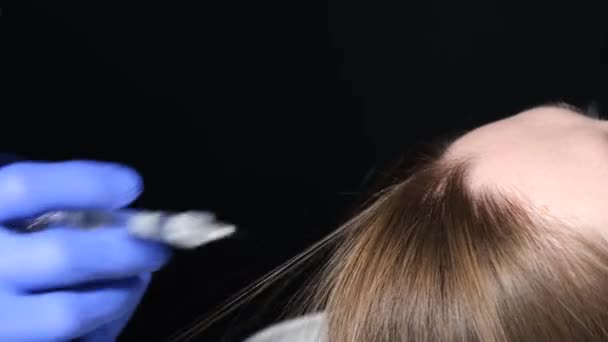 Женщина Трихолог Проводит Мезотерапию Плазменную Терапию Молодой Пациентке Выпадение Волос — стоковое видео