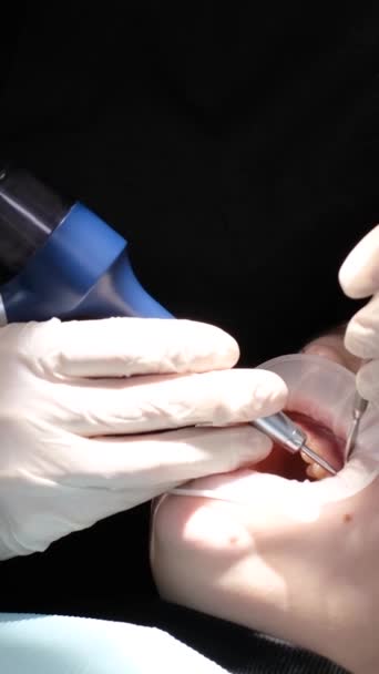 Şlemdeki Dişçi Diş Hizmetleri Diş Hekimliği Diş Hekimliği Dikey Video — Stok video
