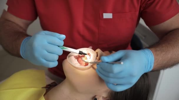 Een Professionele Tandarts Voert Een Tanden Bleken Procedure Mooie Glimlach — Stockvideo