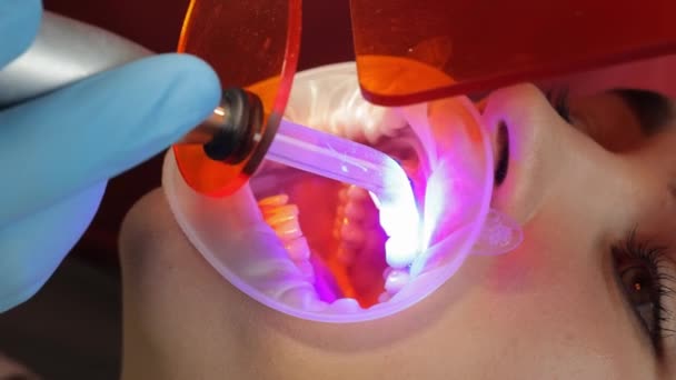 歯科医はプロの歯エナメルホワイトニングを行います 矯正歯科医は 接着されたブレースの残骸を取り除きます 口のクローズアップ 歯医者による治療 — ストック動画