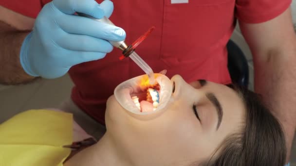 Pendekatan Dari Prosedur Pemutihan Gigi Dengan Lampu Ultraviolet Pasien Perempuan — Stok Video