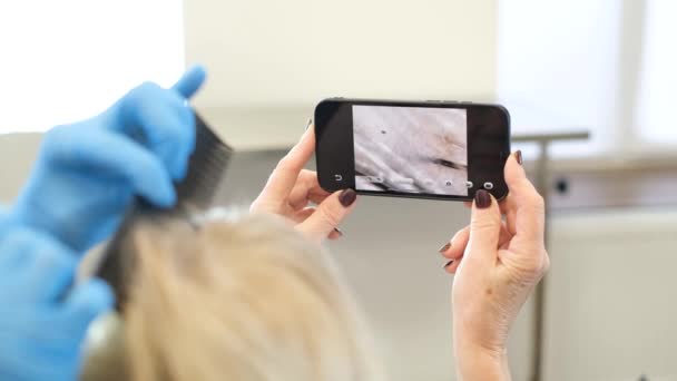 一位老年妇女的头皮由办公室里的一位三位一体的医生治疗 一位女性三叶草学家给病人剃头 并在手机上播放视频 — 图库视频影像