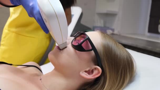 Laser Epilation Face Close Beautician Removes Hair Face Young Girl — стоковое видео