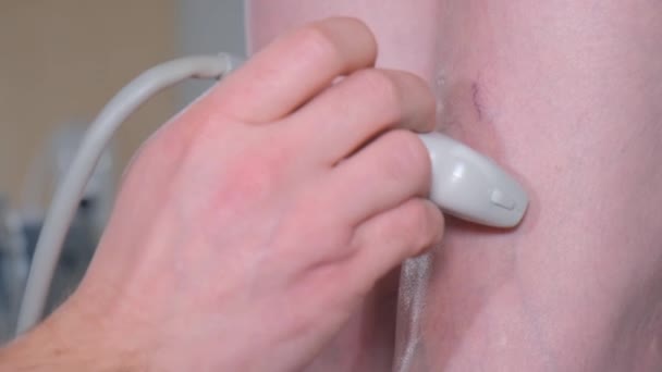 Close Veins Womans Legs Using Ultrasound Machine Professional Doctor Diagnoses — стоковое видео