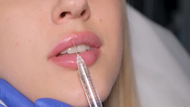 美容師は美しい患者の唇に美しさの注入をする 美容プロセスを若返らせる — ストック動画