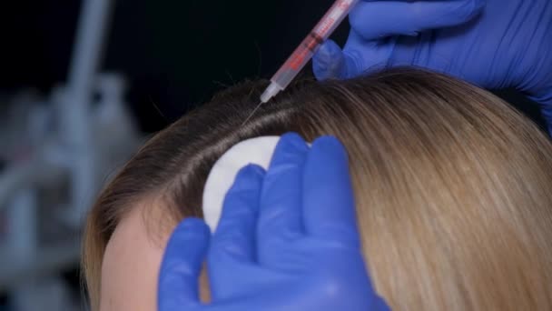 Detailní Záběr Kosmetické Injekce Hlavy Pacienta Postup Proti Vypadávání Vlasů — Stock video