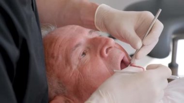 Yaşlı gri saçlı adam dişçi koltuğunda oturuyor, doktor özel diş aletleriyle bakımı yapıyor, doktor çok profesyonel çalışıyor..