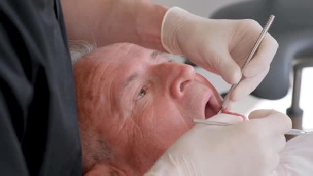 stock video The old gray-haired man is sitting on the dentists chair, the doctor treats caries with special dental tools, the doctor works very professionally.