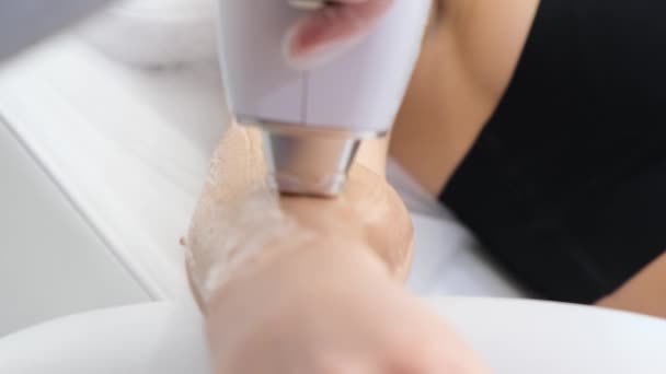 Cosmetician Profesionist Îndepărtează Părul Mâinile Feminine Frumoase Folosind Laser Epilarea — Videoclip de stoc