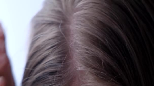 Zbliżenie Wczesnych Siwych Włosów Głowie Młodej Kobiety Problem Siwych Włosów — Wideo stockowe