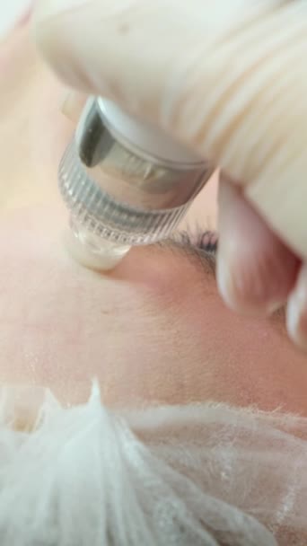Eine Kosmetikerin Führt Einem Schönheitssalon Hydropiling Durch Hautpflege Aus Nächster — Stockvideo
