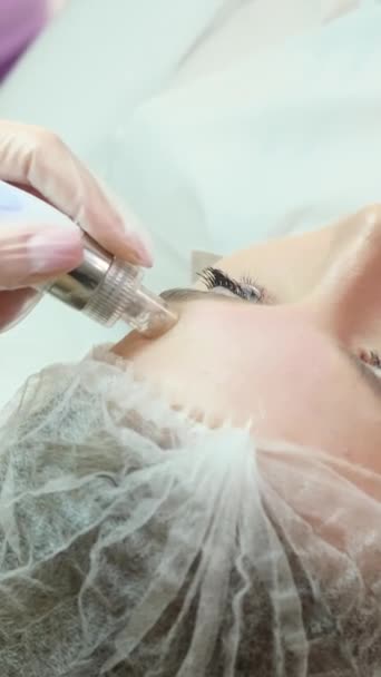 現代装置を使用した化粧品クリニックフェイシャルスキンケア手順 クローズアップ ハードウェア顔のクリーニング手順 バーティカルビデオ — ストック動画