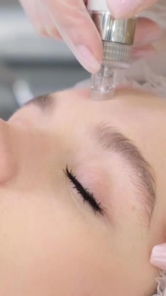 Cuidado Com Pele Facial Close Uma Mulher Recebendo Uma Hidromicrodermoabrasão — Vídeo de Stock