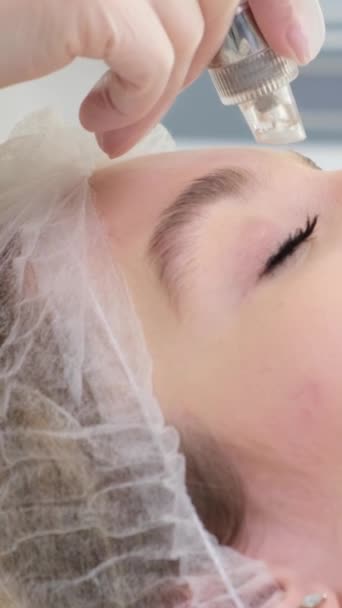 Vista Lateral Mulher Recebendo Terapia Microdermoabrasão Testa Spa Beleza Cosmetologia — Vídeo de Stock