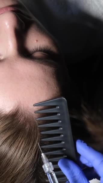 Tricholog Lékařských Rukavicích Podá Ženě Injekci Proti Vypadávání Vlasů Léčba — Stock video