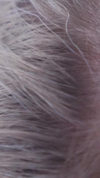 Раннє Сіре Волосся Молодої Жінки Вона Хвилюється Напружується Проблеми Здоров — стокове відео