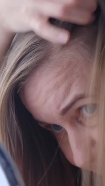 Ранние Седые Волосы Молодой Женщины Обеспокоена Напряжена Проблемы Здоровьем Молодом — стоковое видео