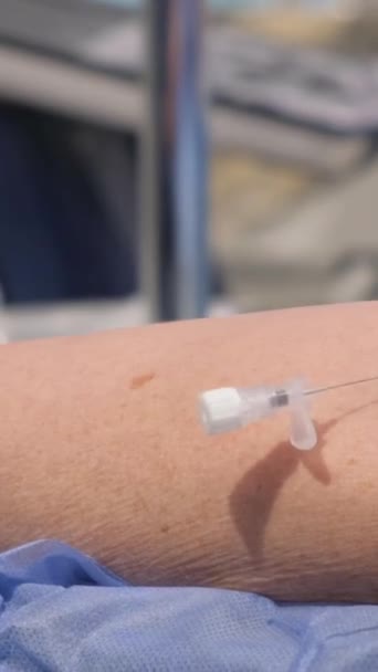 Der Arzt Führt Eine Nadel Eine Vene Ein Und Setzt — Stockvideo