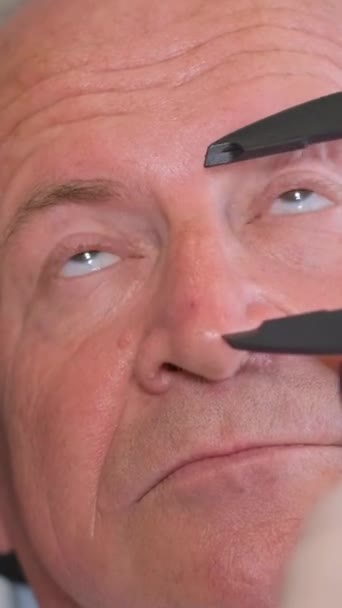 Marquage Visage Homme Âgé Avant Chirurgie Plastique Chirurgien Commence Par — Video