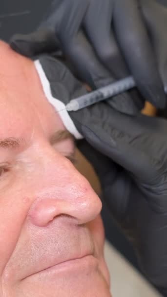 一位美容师给一位老年男子注射抗衰老的面部注射 皮肤科医生给他注射 老年时脸上都是皱纹 垂直录像 — 图库视频影像