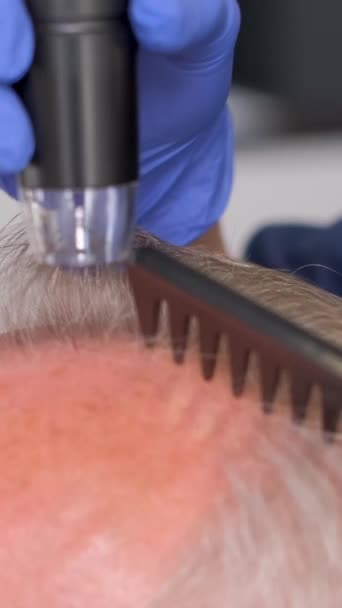 一位老年病专家正在对老年人进行检查 头发护理的概念 垂直录像 — 图库视频影像