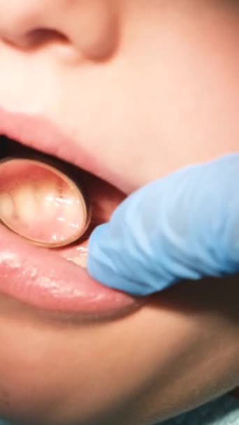 Vizita Copilului Dentist Examinarea Dinților Cariile Dinților Lapte Tratamentul Dentar — Videoclip de stoc