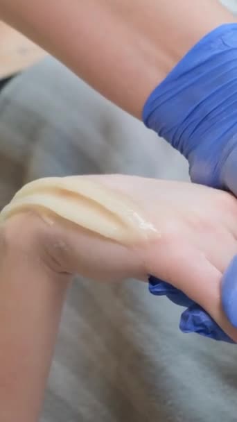 Saç Kesiminden Önce Ellerin Derisine Şeker Yapıştırma Işlemi Ellerin Derisindeki — Stok video