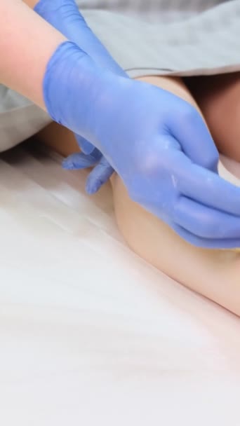 戴手套的美容师把一个年轻女人腿上的毛去掉了 从腿的皮肤上去除毛发的过程 垂直录像 — 图库视频影像