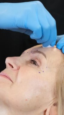 Nitelikli bir kozmetik uzmanı modern bir klinikte yaşlı bir bayan hastaya gençleştirme ve yüz gerdirme için güzellik enjeksiyonu yapar. Dikey video