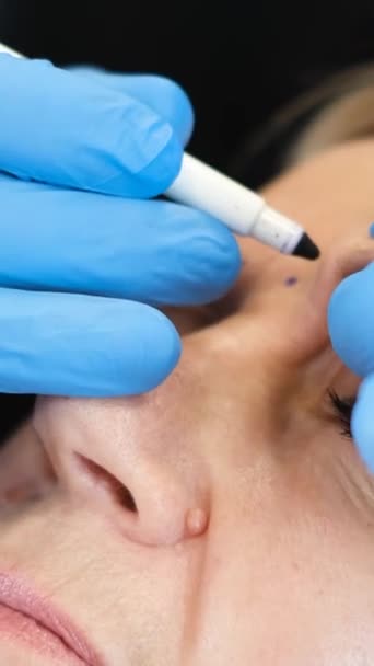Femeie Bătrână Frumoasă Perforare Față Înainte Operația Chirurgicală Plastică Cosmetologul — Videoclip de stoc