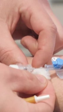 Profesyonel doktorlar tarafından yaşlı bir hastanın ameliyat tedavisi. Bir doktor yardımcısı hastanın koluna kateter yerleştirir. Dikey video