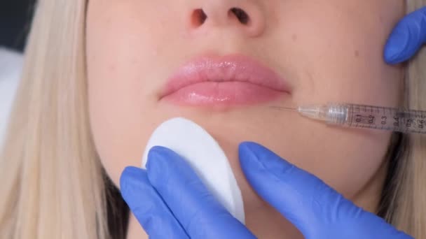 一个年轻的女人在嘴唇上注射肉毒杆菌素 一个女人在美容院里整形外科诊所 靠近点垂直录像 — 图库视频影像