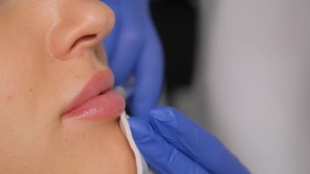 Seorang Kosmolog Membuat Suntikan Bibir Seorang Gadis Cantik Prosedur Penambahan — Stok Video