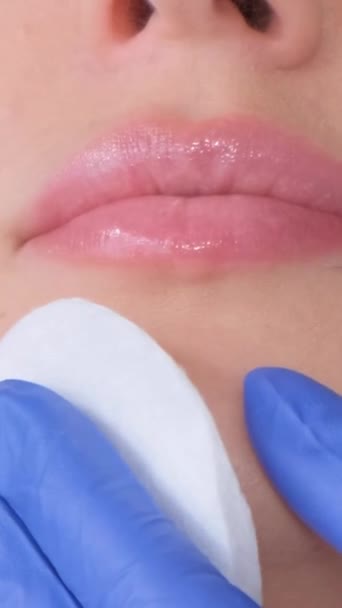 一个年轻的女人在嘴唇上注射肉毒杆菌素 一个女人在美容院里整形外科诊所 靠近点垂直录像 — 图库视频影像
