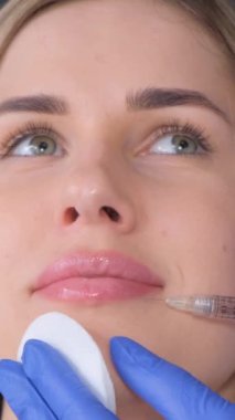 Hiyalüronik asitle dudak büyütme, şekillendirme, canlandırma. Dikey video.