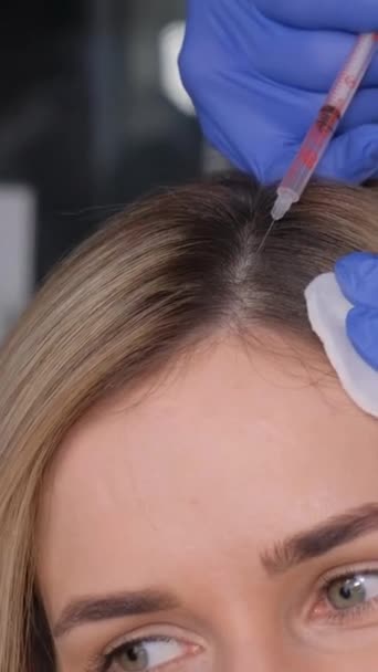Trycholog Robi Zastrzyki Głowę Pięknej Dziewczyny Leczenie Problematycznych Włosów Piękne — Wideo stockowe