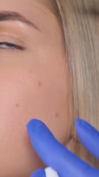장갑을 외과의사는 주름의 모양을 방지하기 얼굴의 피부에 주사를 만듭니다 비디오 — 비디오