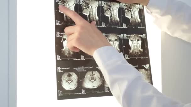 Seorang Vertebrologis Memeriksa Gambar Sinar Dari Tulang Belakang Pasien Wanita — Stok Video